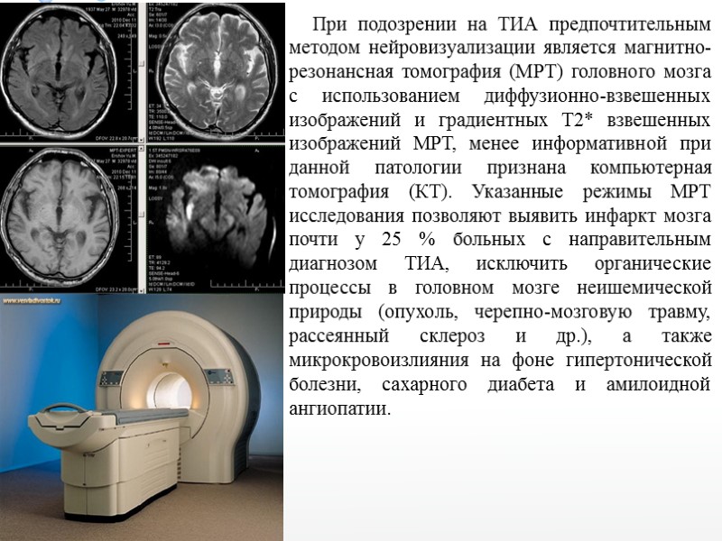 При подозрении на ТИА предпочтительным методом нейровизуализации является магнитно-резонансная томография (МРТ) головного мозга с